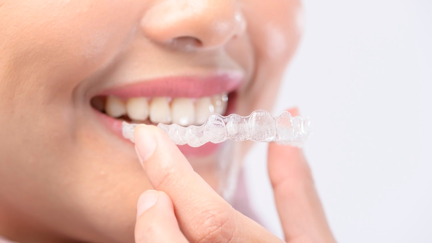 Your Trusted Dentist Near Me: Comprehensive Dental Care for Every Smile