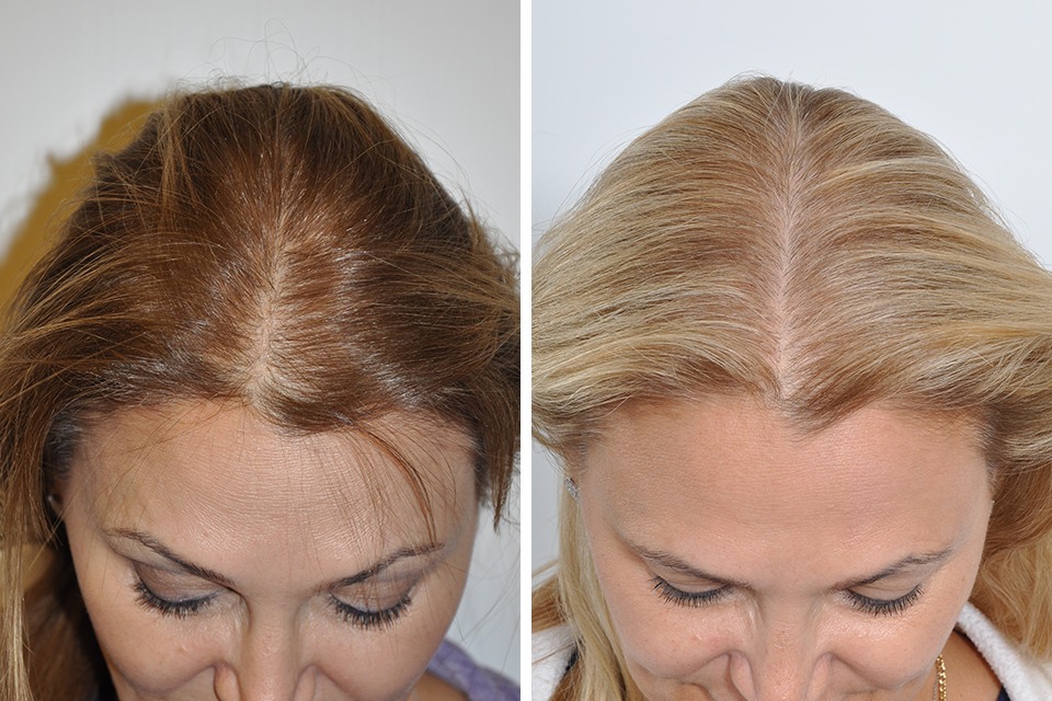 Westminster Medical Group® – Leading Hair Transplant UK Specialists