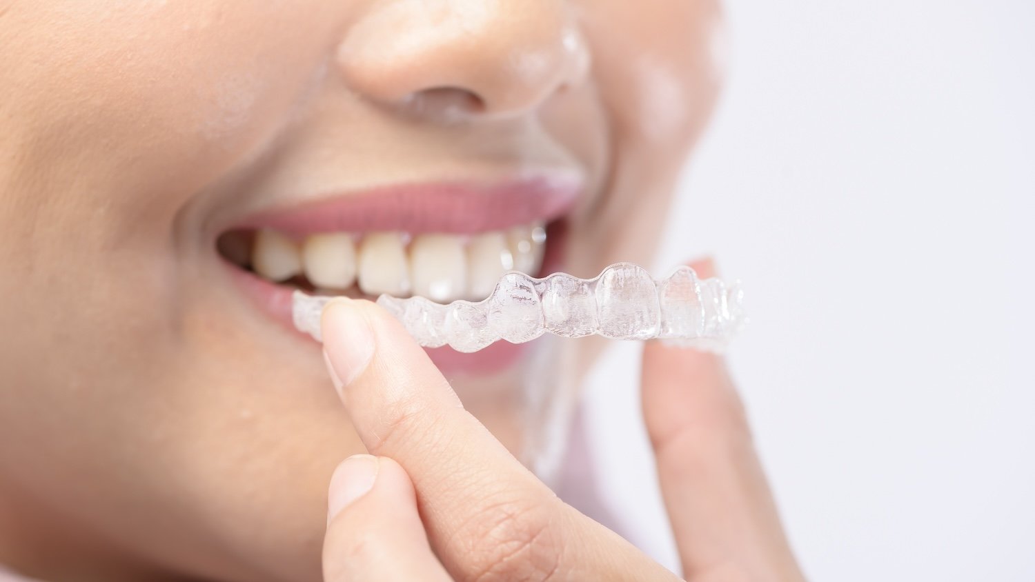 Your Trusted Dentist Near Me: Comprehensive Dental Care for Every Smile