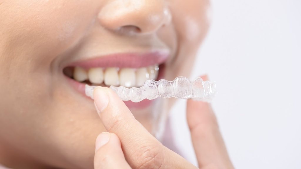 Young smiling woman holding invisalign braces over white background studio, dental healthcare and Orthodontic concept.